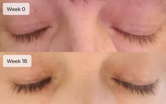SOCO member growing eyelashes after treatment; Week 0: short and thin eyelashes; Week 16: longer and fuller eyelashes
