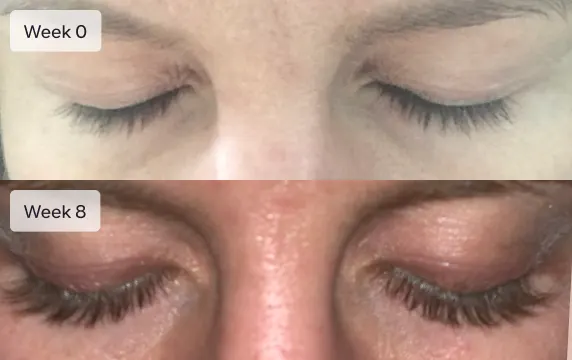 SOCO member growing eyelashes after treatment; Week 0: short and thin eyelashes; Week 8: longer and fuller eyelashes