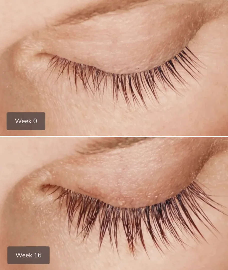 SOCO member growing eyelashes after treatment; Week 0: short and thin eyelashes; Week 16: longer and fuller eyelashes